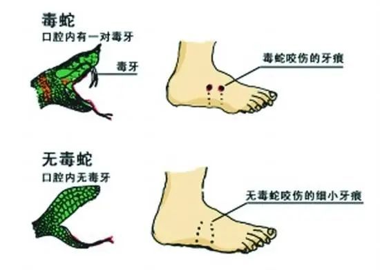 家属质疑医院延误救治！当地卫健委介入！AG真人平台app女子三亚疑被蛇咬身亡